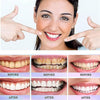 Oralhoe Whitening Toothpaste  معجون أسنان أورالهو لتبييض الأسنان