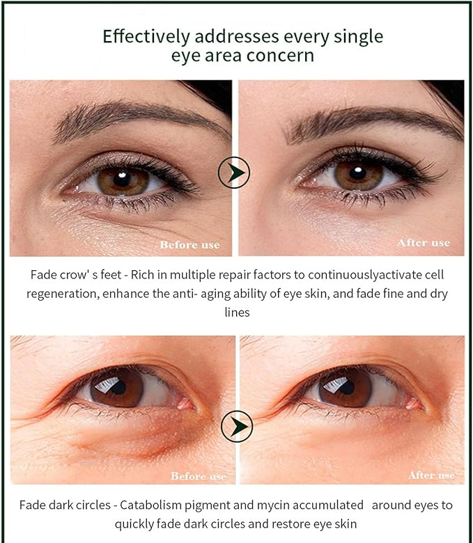 Time Eraser Eye Essence Oil  زيت/إيسنس تيم إرازر لمنطقة تحت العين